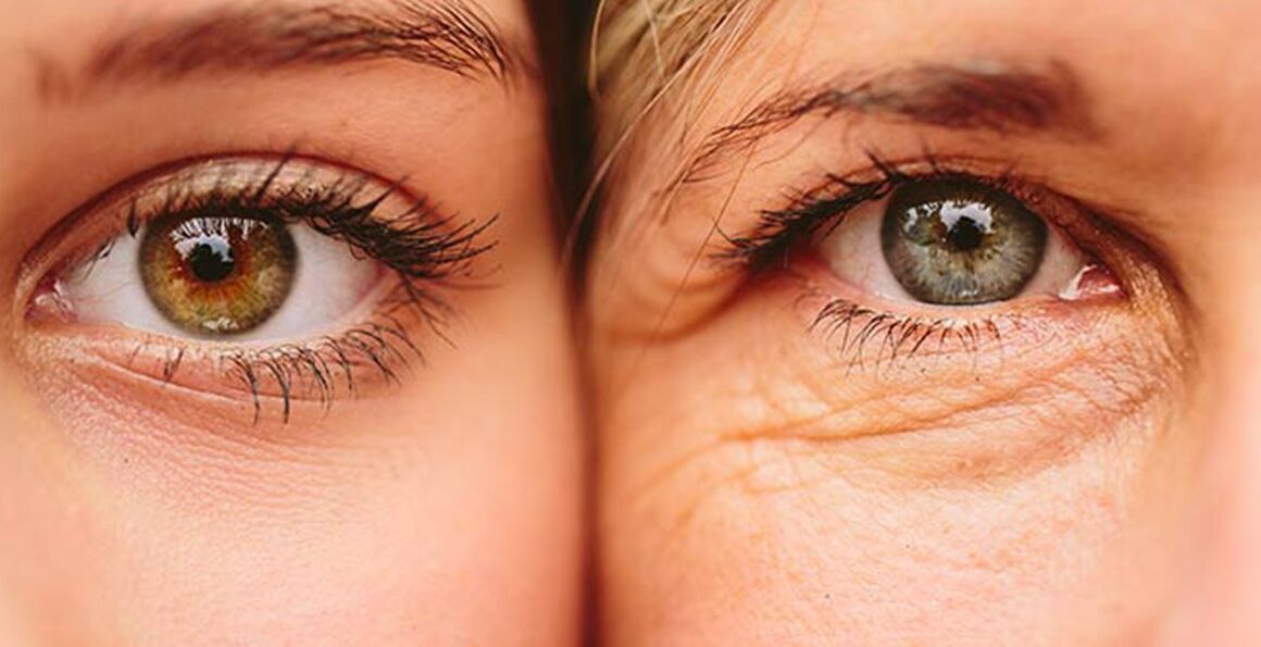 Vnější známky stárnutí kůže kolem očí u dvou žen různého věku